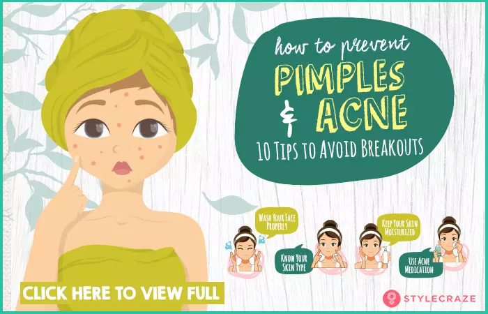 Infographic on how to prevent pimples and acne