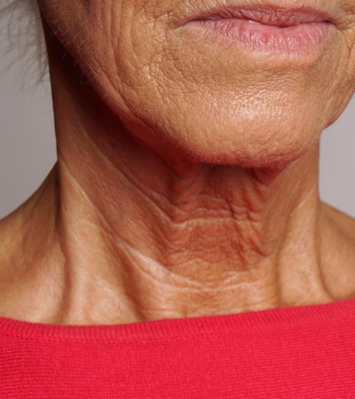 How to Prevent Neck Wrinkles?