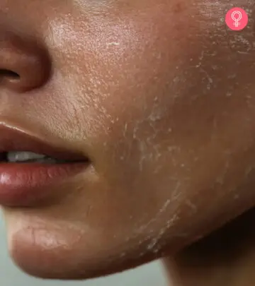 From dryness to an underlying medical condition, there are many reasons for skin peeling.