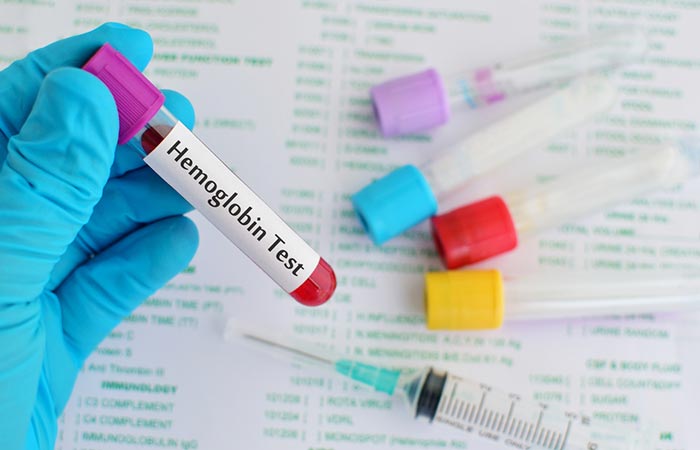 Get a hemoglobin test to check your iron levels