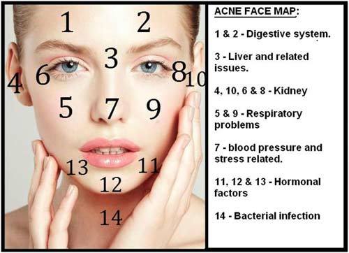 where the acne on your face means