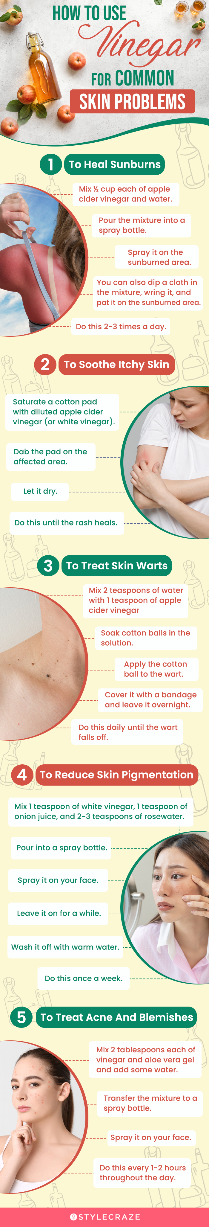 how to use vinegar for common skin problems (infographic)