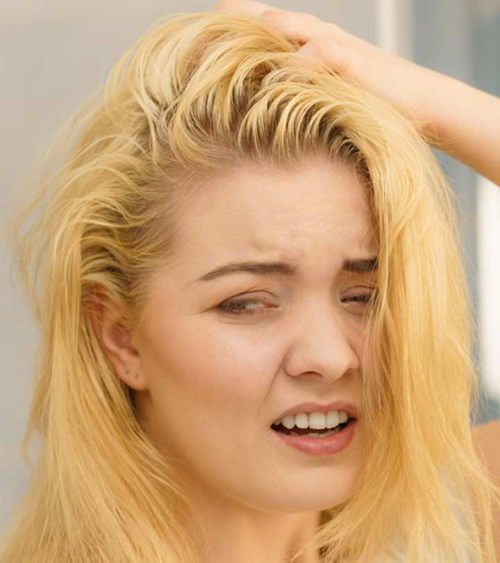 Dirty Greasy Brown Long Hair Dandruff Stock Photo 2185598605  Shutterstock