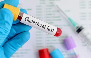 Rosehips benefits include lowering cholesterol