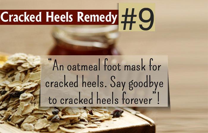 20 Simple Home Remedies For Cracked Heels