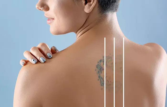 A woman showing her tattoo fading after each session