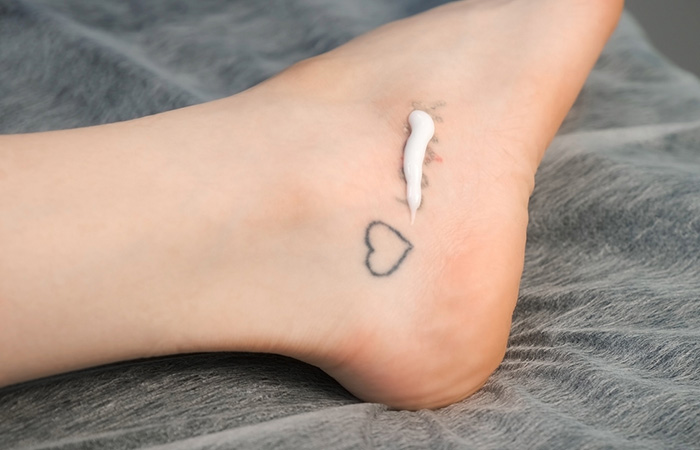 Tattoo removal cream applied on an unwanted tattoo