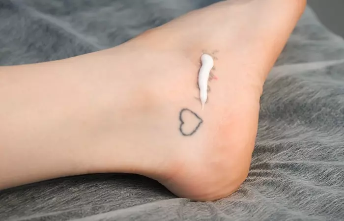 Tattoo removal cream applied on an unwanted tattoo