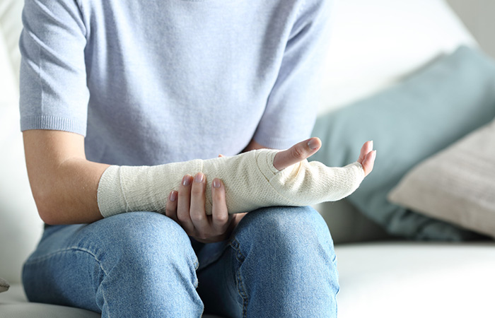 Woman with fractured arm may have copper deficiency
