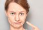 Toothpaste For Pimples: Does It Really Work? - Acne