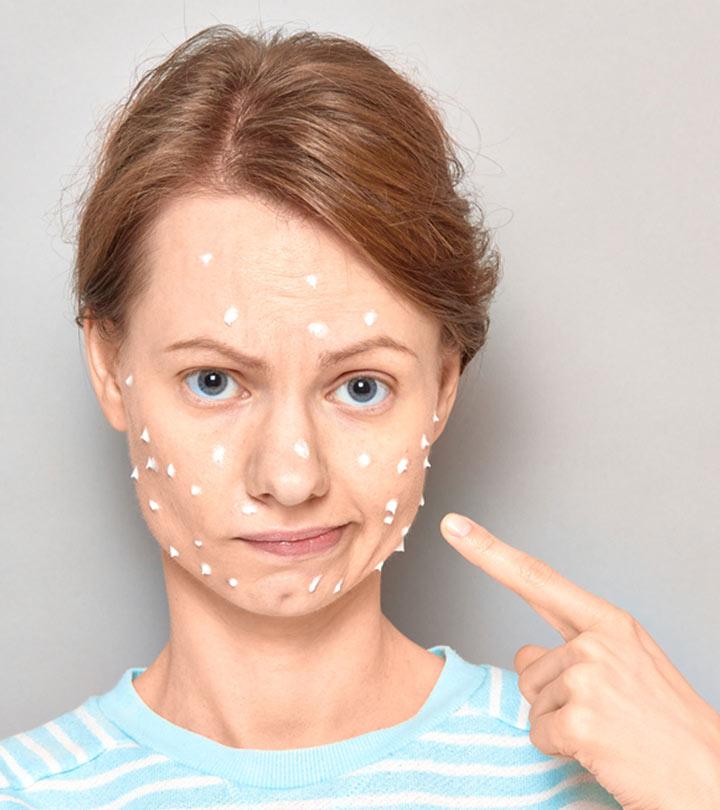 Toothpaste For Pimples: Does It Really Work?