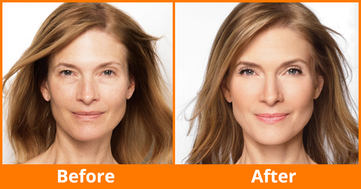 face lift mask before and after
