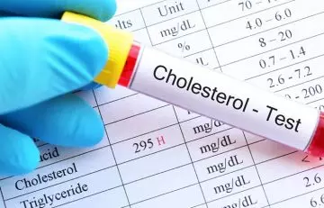 High cholesterol test results