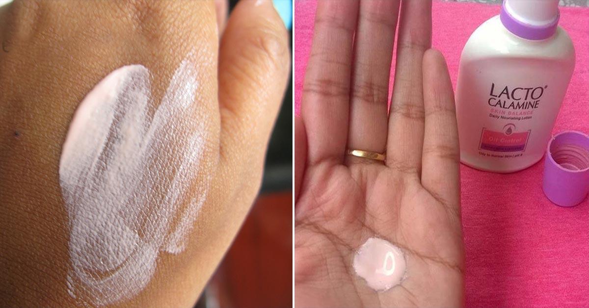 calamine lotion on baby face