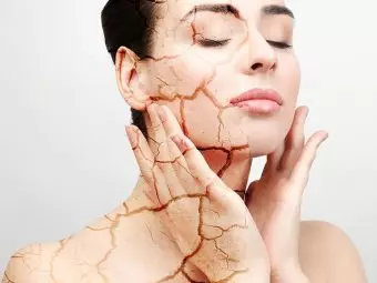 How To Use Multani Mitti For Dry Skin