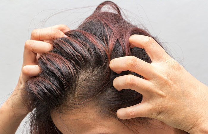 Straightening causes an itchy scalp