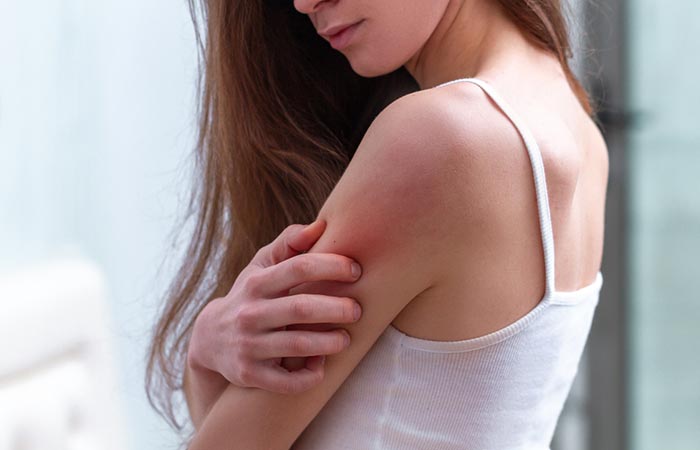 Woman having a rash as a side effect of consuming wheatgrass