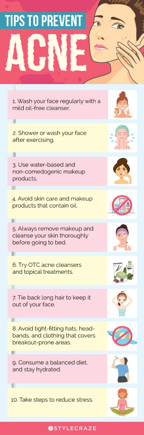 tips to prevent acne (infographic)