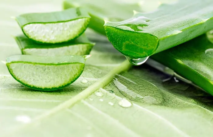 How to get rid of heat pimples with aloe vera