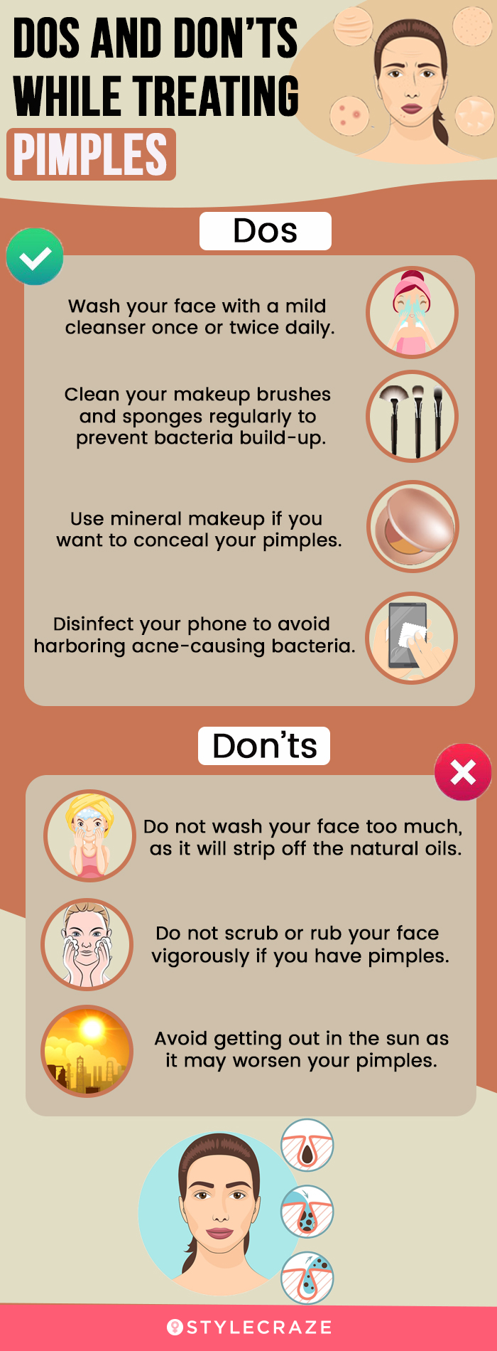 dos and don’ts while treating pimples (infographic)