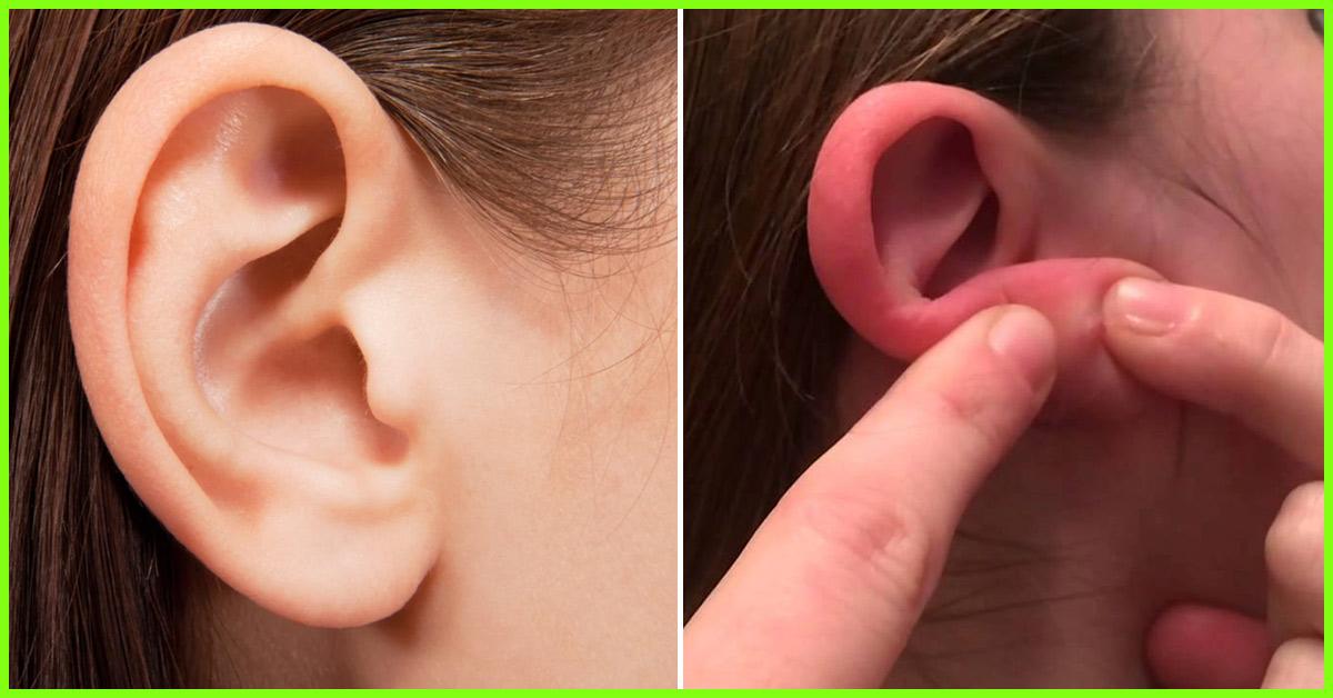 9-causes-of-lump-behind-ear-symptoms-treatment-and-home-remedies