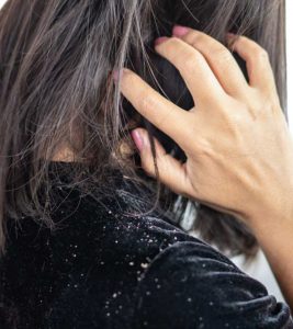 What Is The Truth About Hair Oils For Dandruff