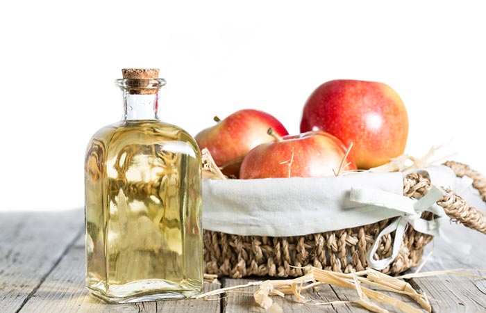 Apple cider vinegar for scalp psoriasis
