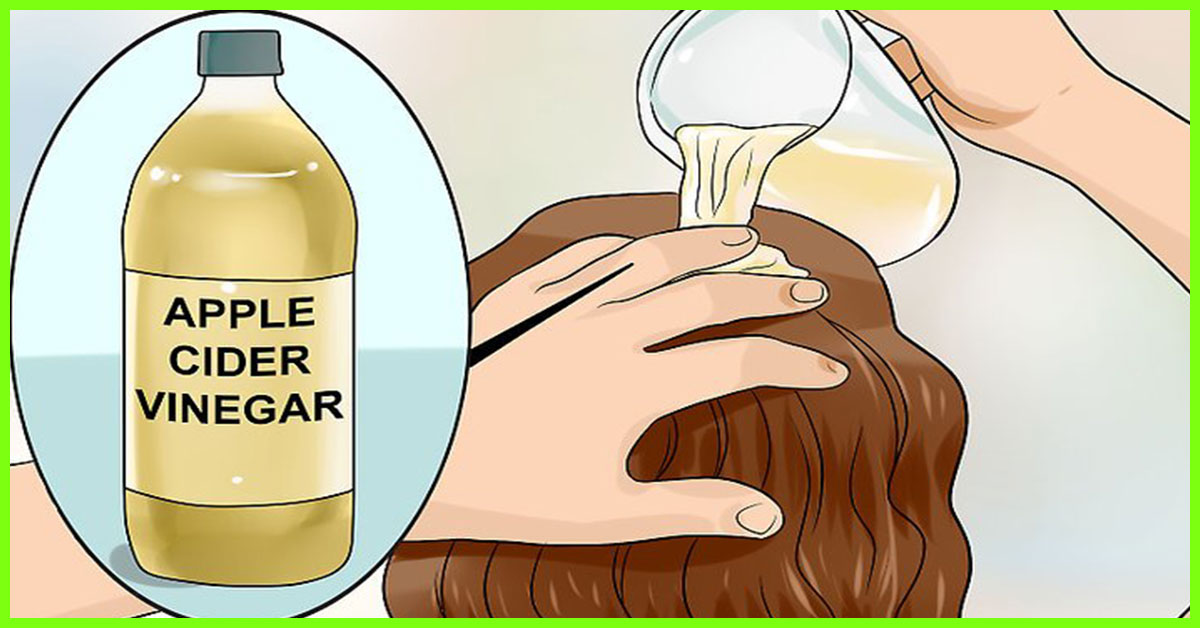 homemade shampoo for psoriasis