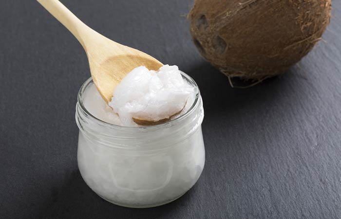 Coconut Oil for scalp psoriasis