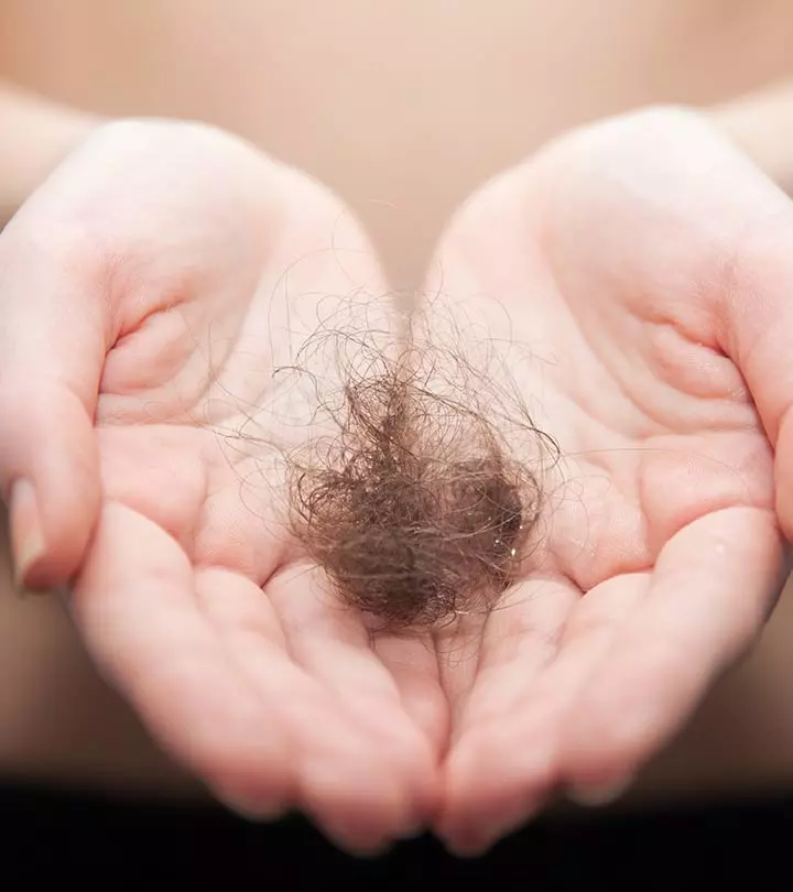Personal hair hygiene is absolutely essential for managing this hair loss.