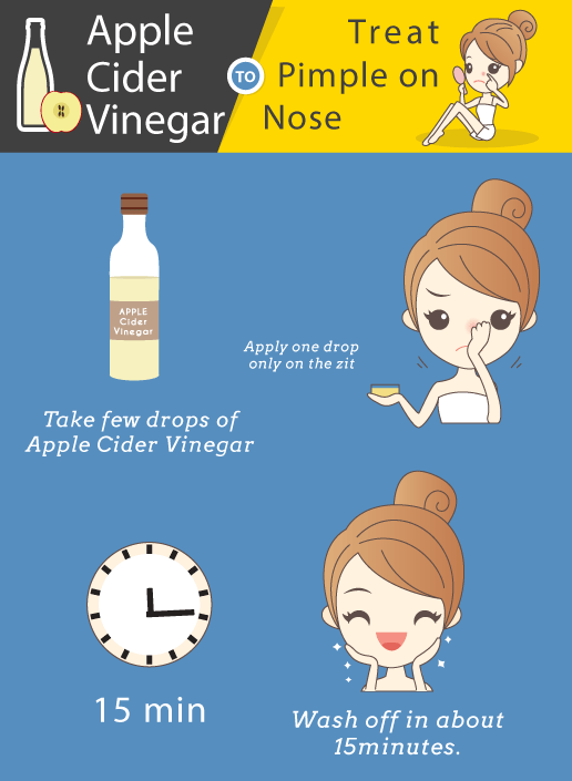 4. Vinagre de maçã para sidra o que tem de fazer o que tem de fazer aplica-o directamente na borbulha do nariz e deixa-o secar naturalmente.lavar em cerca de 15 minutos.