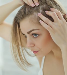 8 Simple Ways To Treat Hair Loss At The T...