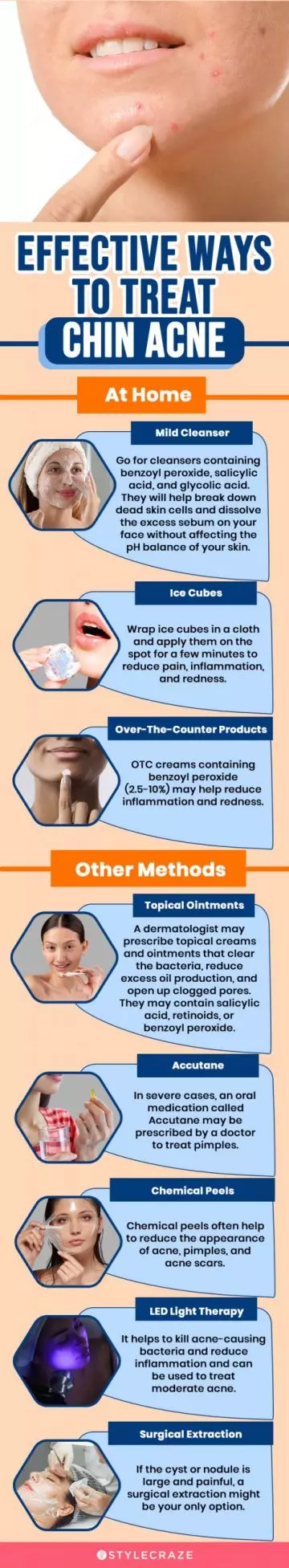 effective ways to treat chin acne (infographic)