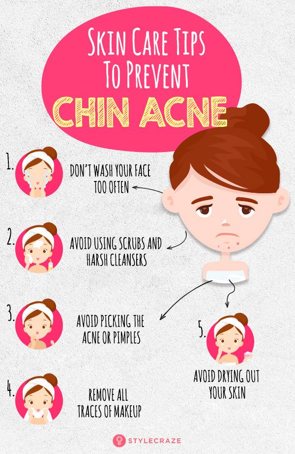 Chin Acne & Acne: Reasons, Therapy, And Skin Care Tips - Health and ...