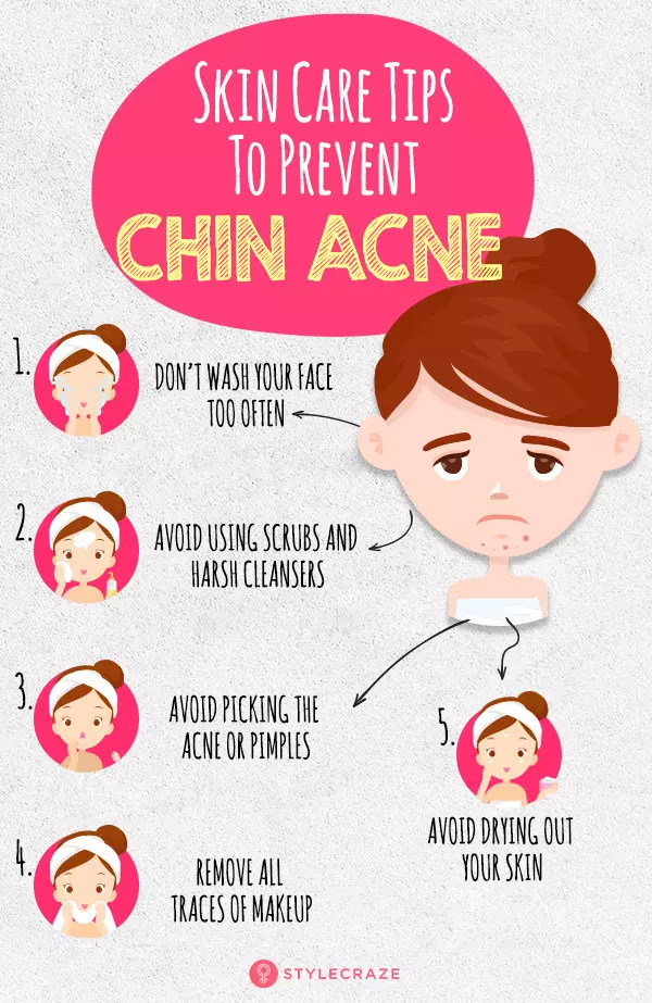 Chin acne