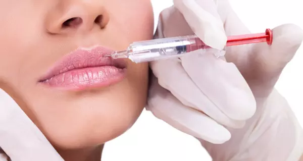 Lip augmentation to stop lip bleeding Lip augmentation to stop lip bleeding