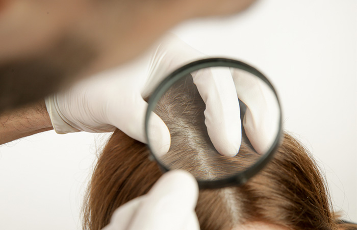 Ozone therapy improves scalp health