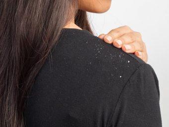The Early Signs And Symptoms Of Dandruff