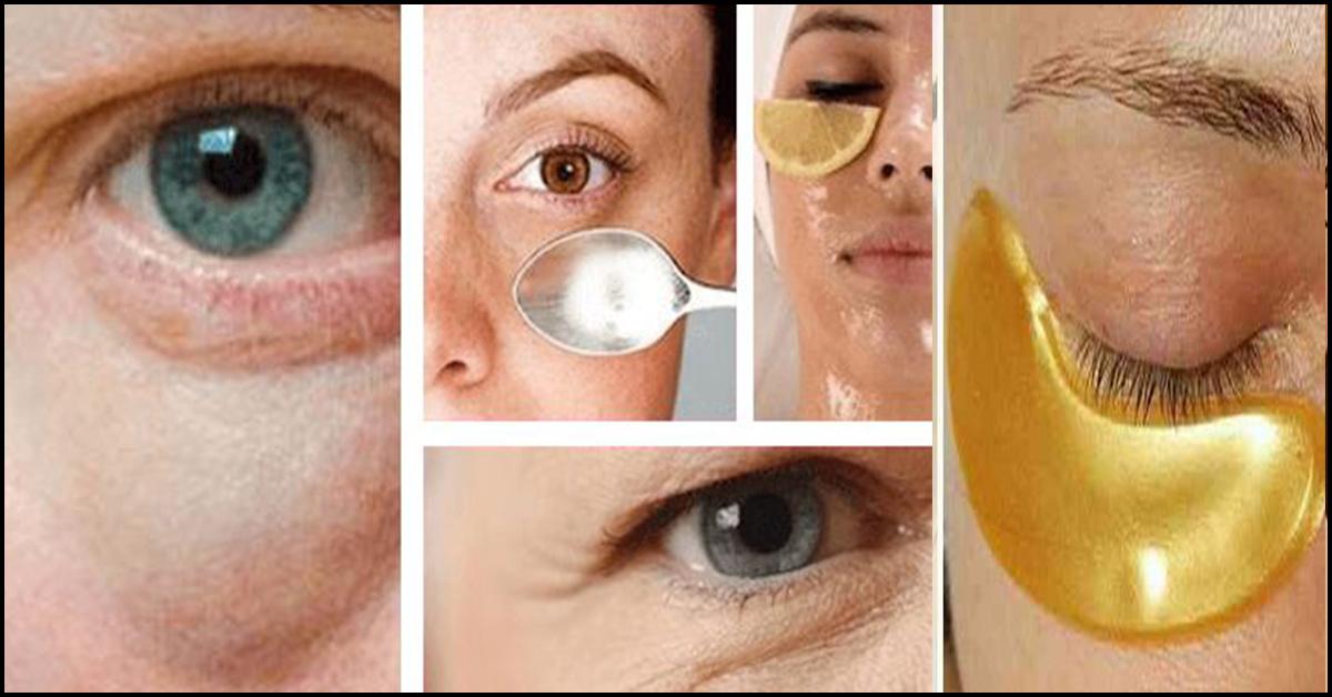 16 Home Remedies To Get Rid Of Eye Bags