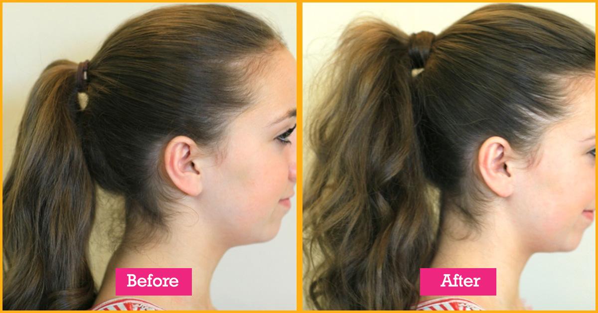 Hairstyles To Cover Hair Loss