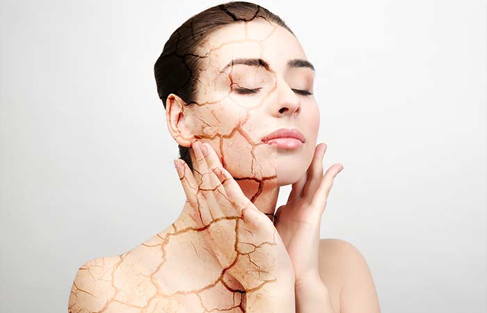 Treatment of Dry Skin