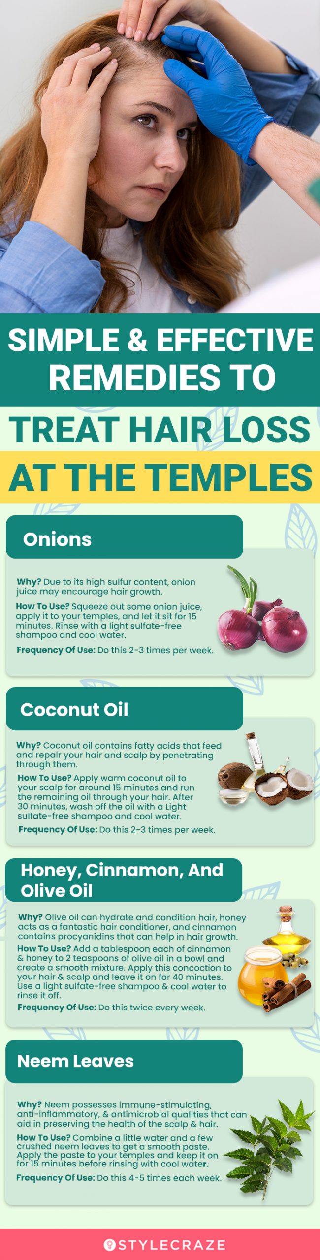 simple and effective remedies to treat hairloss at the temples (infographic)