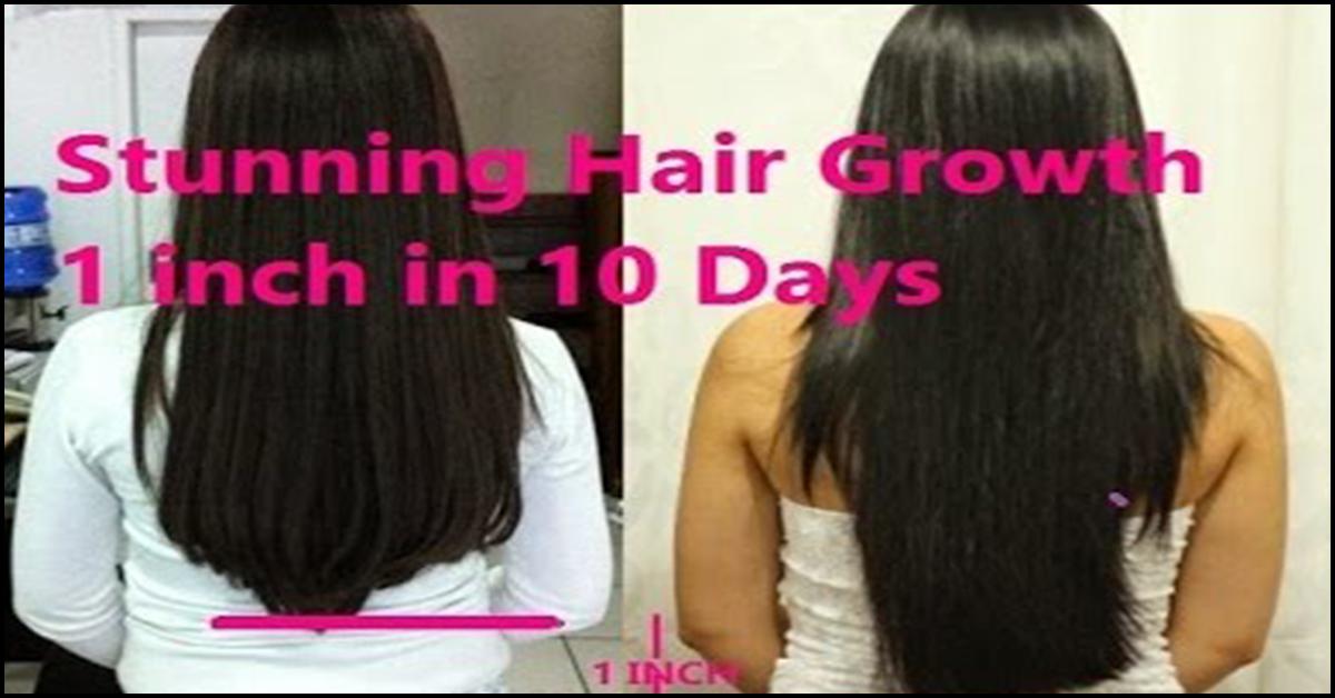 10 Best Hair Growth Tonics That Actually Work