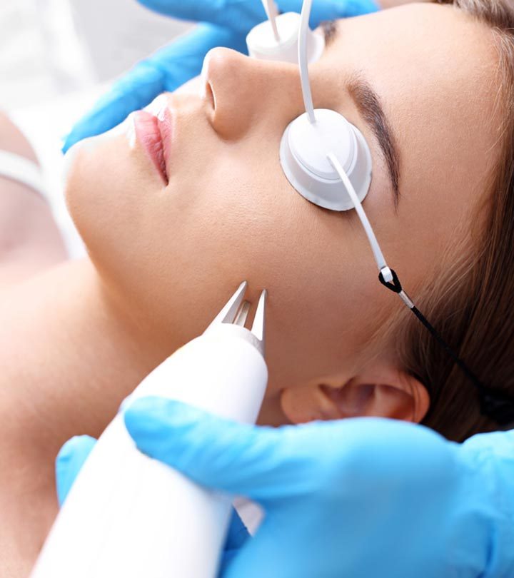 Laser Treatment For Acne Scars: How It Works, Types, Effectiveness, And More