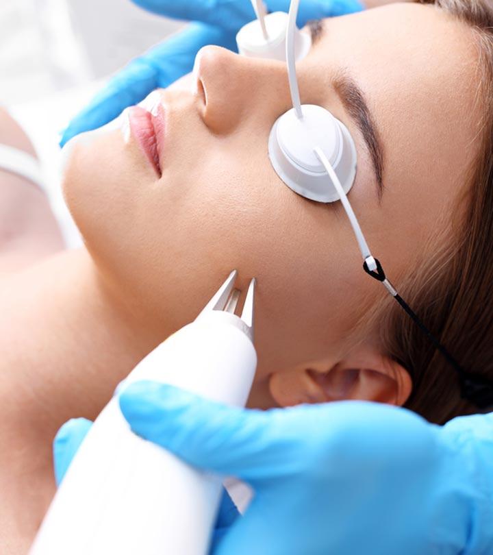 Risk caused by chemical peel Risk caused by chemical peel