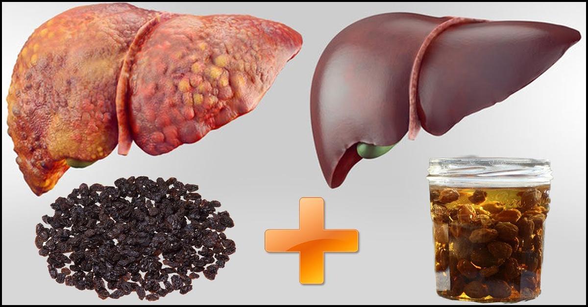 What Are 15 Foods That Are Good For Your Liver