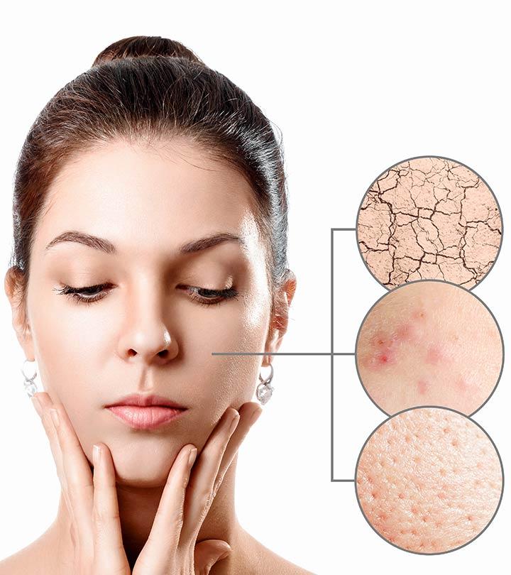 Dry itchy skin on face remedies