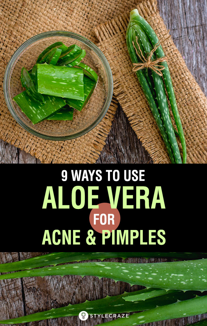 Aloe Vera For Acne 9 Ways To Use Aloe Vera For Pimples