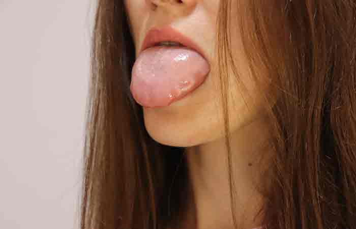 Close-up-of-a-woman-with-swollen-tongue-as-a-side-effect-of-acai-berries