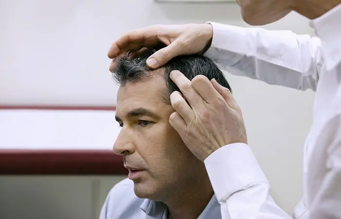 Doctor examining the scalp of a man